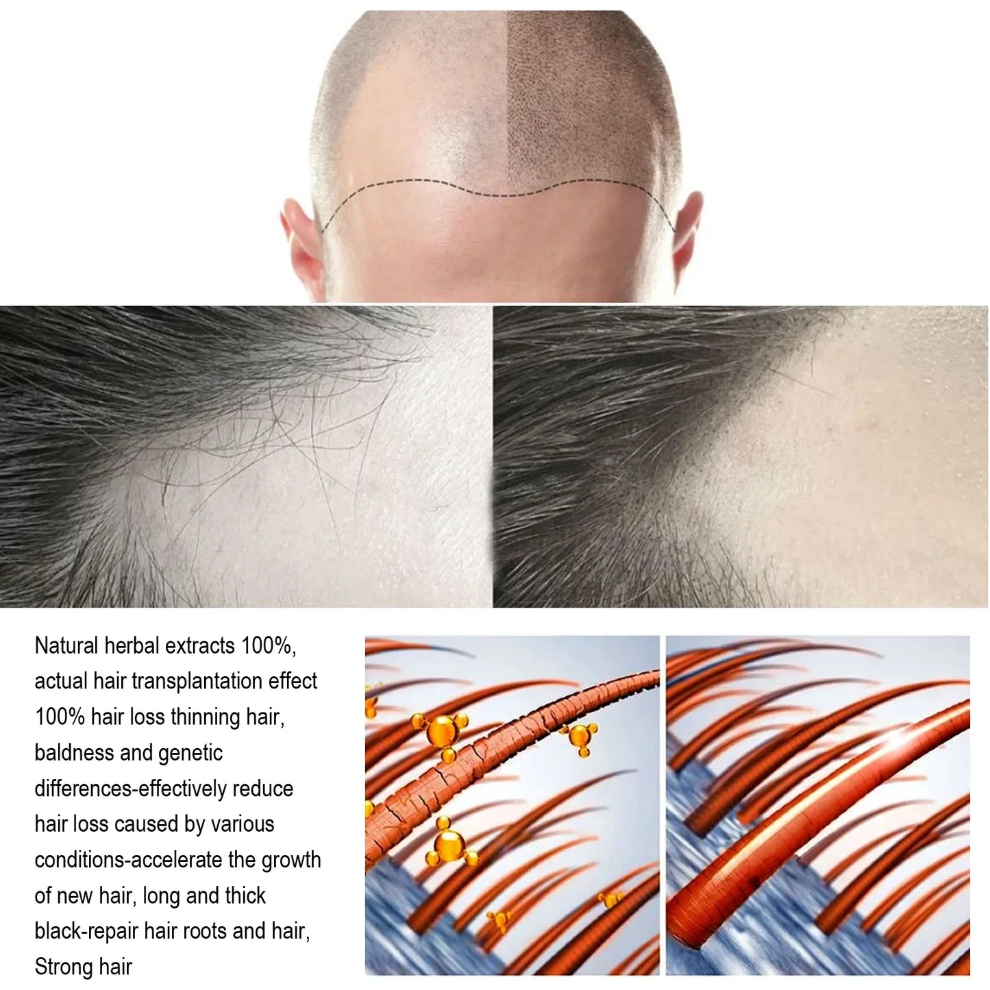 Anti falling dense hair essence scalp care firm dense hair repair hair root thick nutrition strong