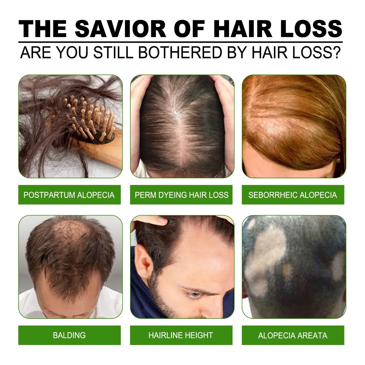 Anti falling dense hair essence scalp care firm dense hair repair hair root thick nutrition strong
