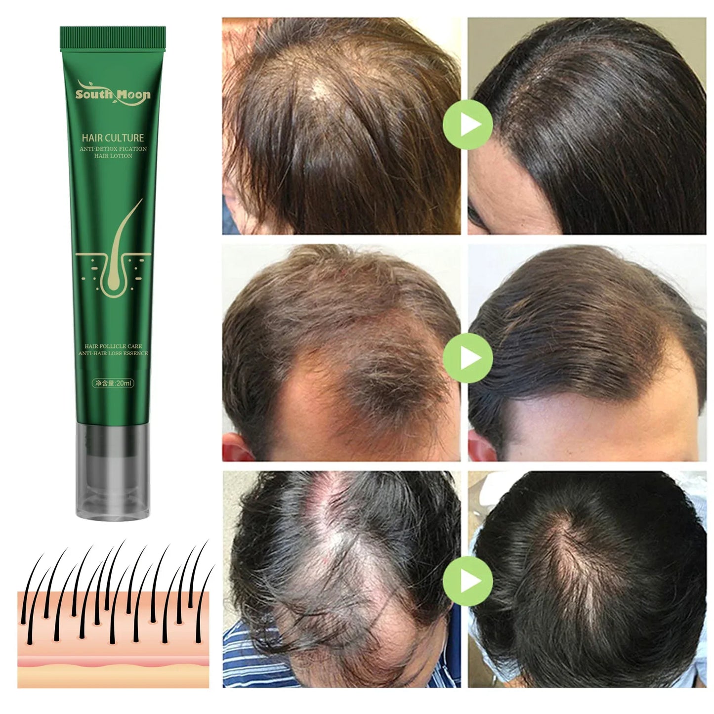 Anti falling dense hair essence scalp care firm dense hair repair hair root thick nutrition strong