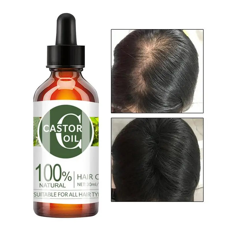 30ml Hair Growth Essential Oil Strengthening Plant Hair Nutrition Oil For Women Hair Care Supplies For Straight Curly Long Hair