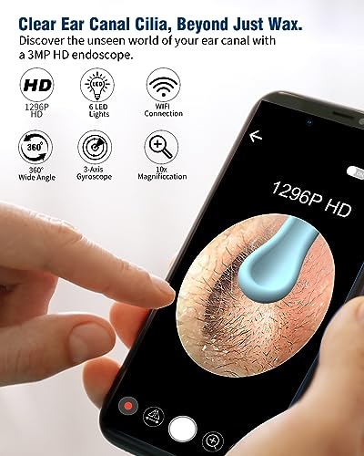 ClearVision EarCam