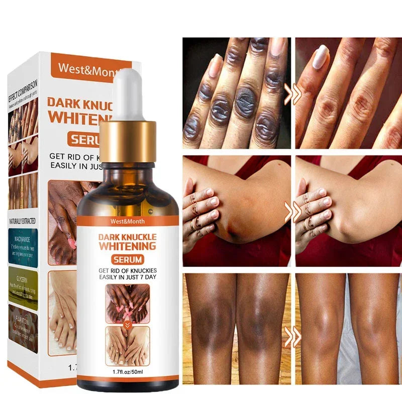 Joint Melanin Removal Serum Lighten Black Knee Ankle Brighten Skin Care Tone Body Armpit Whitening Rejuvenation Bleaching Cream