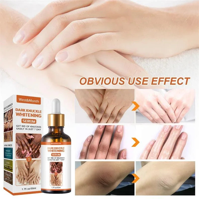 Joint Melanin Removal Serum Lighten Black Knee Ankle Brighten Skin Care Tone Body Armpit Whitening Rejuvenation Bleaching Cream
