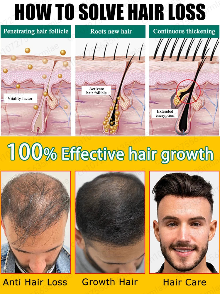 Hair growth essential oil, repair hair loss and baldness, restore thick hair