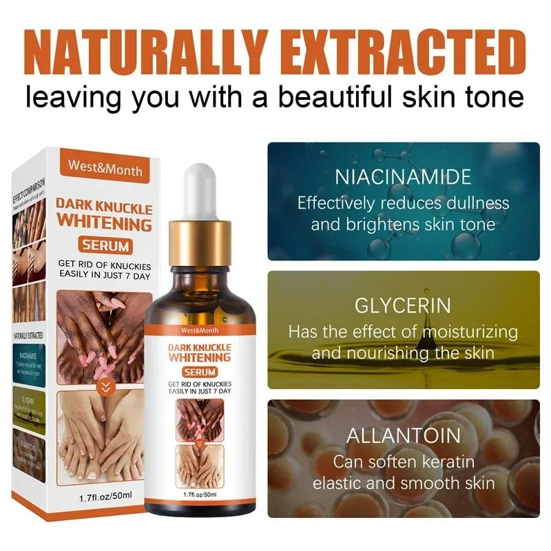 Joint Melanin Removal Serum Lighten Black Knee Ankle Brighten Skin Care Tone Body Armpit Whitening Rejuvenation Bleaching Cream