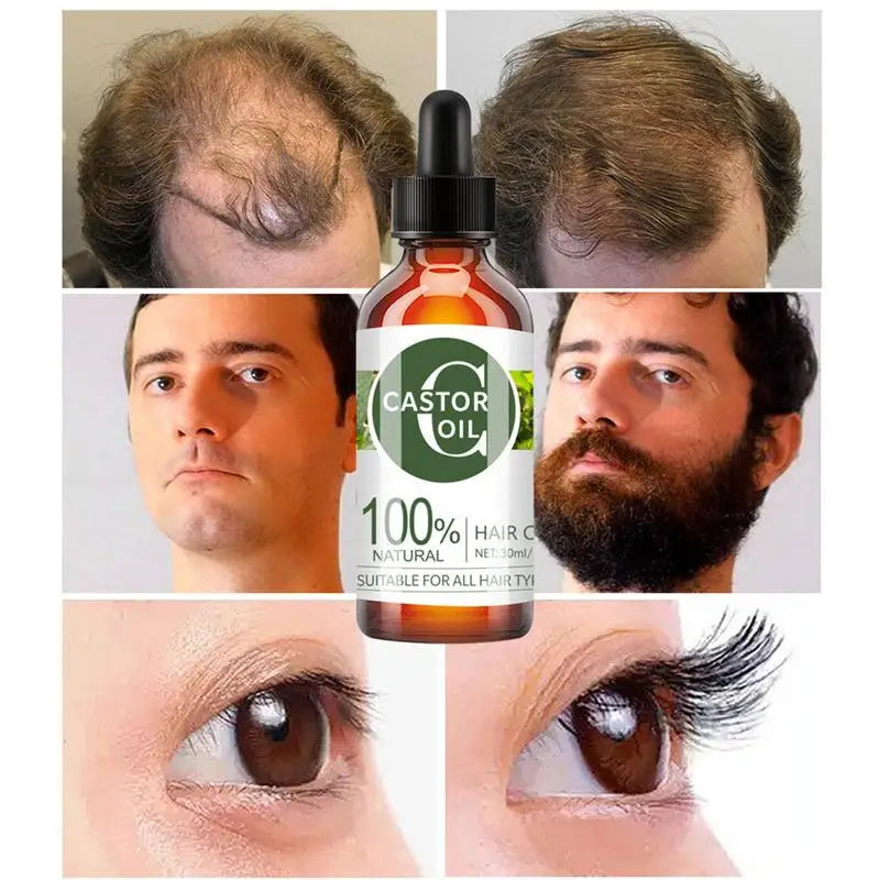 30ml Hair Growth Essential Oil Strengthening Plant Hair Nutrition Oil For Women Hair Care Supplies For Straight Curly Long Hair
