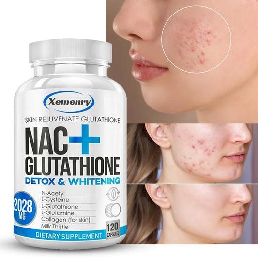 NAC+ Glutathione Supplement - Body Detoxification, Collagen Whitening Capsules