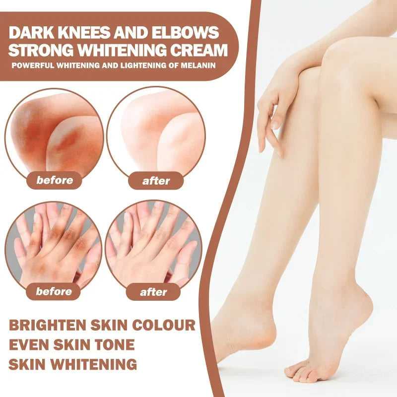 Joint Melanin Removal Serum Lighten Black Knee Ankle Brighten Skin Care Tone Body Armpit Whitening Rejuvenation Bleaching Cream