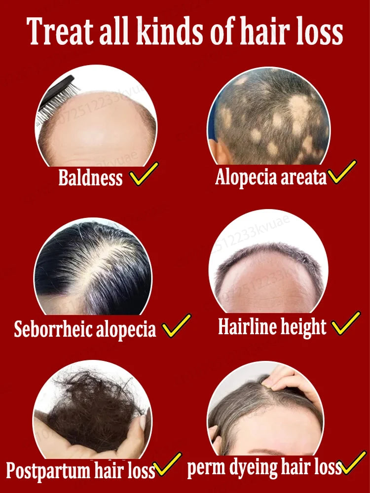 Hair growth essential oil, repair hair loss and baldness, restore thick hair